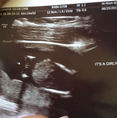 She Had Her 3 Lines From Every Angle Mommys Princess Glow Community
