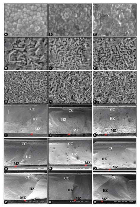 Scanning Electron Microscope Photomicrographs Indicated Grain Size And Download Scientific