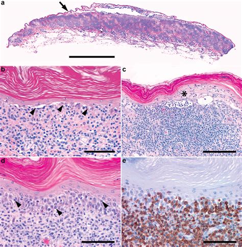 Figure 4 From Canine Cutaneous Epitheliotropic T Cell Lymphoma With