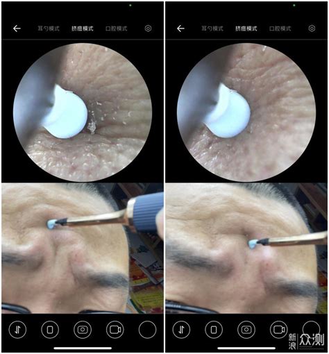 可视采耳干净又放心 Bebird三合一可视采耳仪试用报告新浪众测