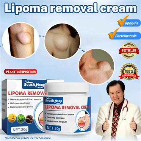 Lipoma Removal Cream Original Lipoma Cream Made In Japan Lipoma Cream