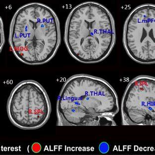 Brain Regions Of Interest Showing Significant Alff Differences