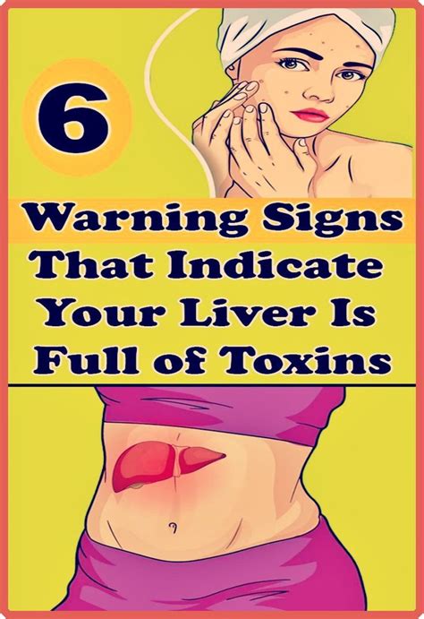 Warning Signs That Indicate Your Liver Is Full Of Toxins Artofit