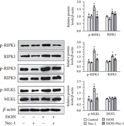 Necrostatin And Nac Treatment Inhibited The Ripk Ripk Mlkl