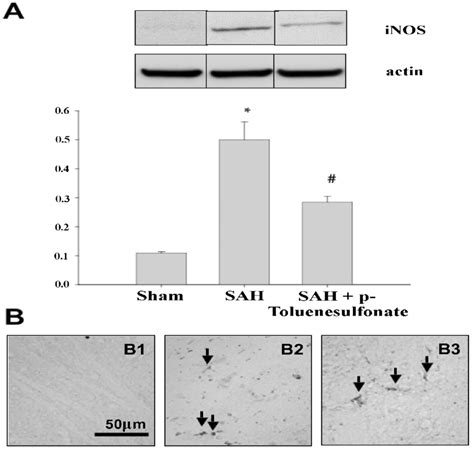 Inducible Nitric Oxide Synthase Inos Expression In The Cortex H