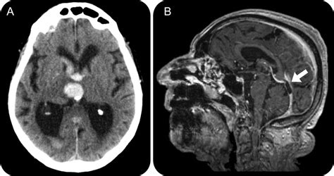 Teaching NeuroImages A Look Beneath The Surface In A Typical