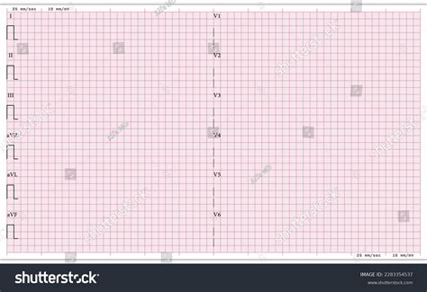 Blank Ecg Paper 12 Lead Electrocardiogram Stock Vector Royalty Free