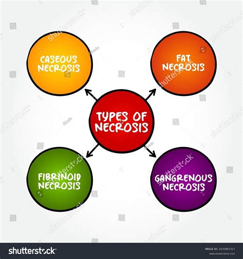 Types Necrosis Death Body Tissue Mind Stock Vector Royalty Free