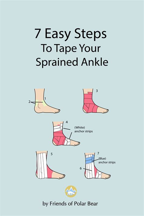 Easy Steps To Tape Your Sprained Ankle Sprained Ankle Ankle Taping