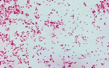 Klebsiella Pneumoniae Gram Stain / Micro-Lab Mid Term at Auburn ...