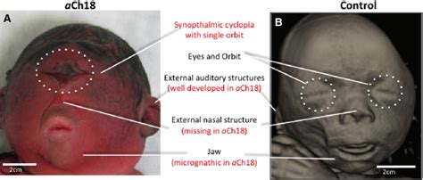 Cyclopia Survivor