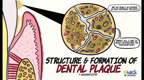 Dental Plaque: Structure and Formation | Dental plaque, Dental, Dentistry