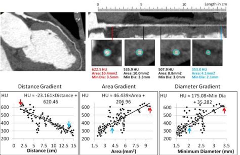 Patterns Of Opacification In Coronary Ct Angiography Contrast