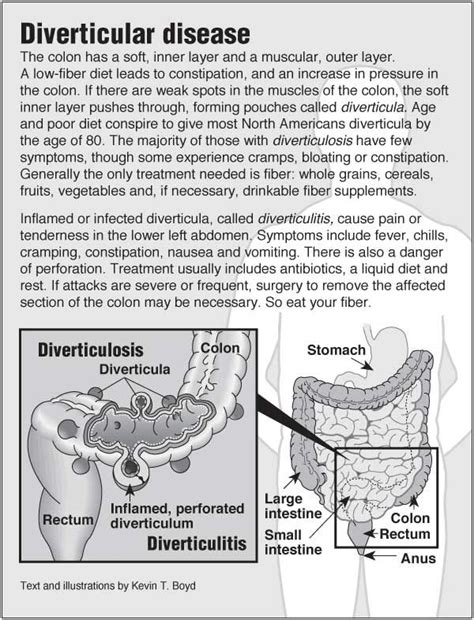 Pin on Health Infographics