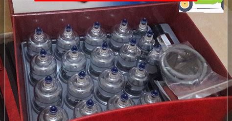 Supplier Alat Bekam Sammora Isi 12 Alun-Alun Contong WA 089501303806 ...