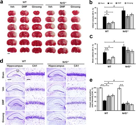 Pretreatment With Dmf Or Ginseng Reduces Ischemia Induced Infarct