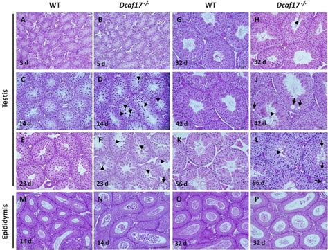 Histology Of Testes And Cauda Epididymides From Wt And Dcaf17 − − Mice