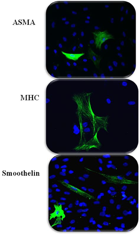 Immunocytochemistry Of Induced Human Adipose Derived Stem Cellssmooth