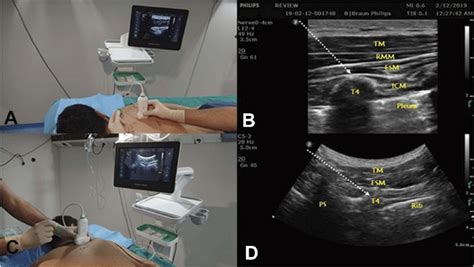 A Position And Orientation Of The Ultrasound Transducer During A