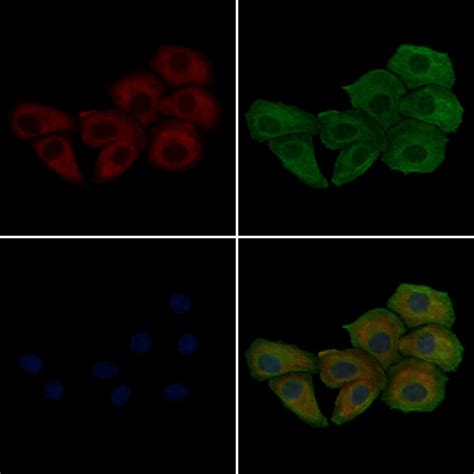 Phospho Phospholamban Ser16 Thr17 Polyclonal Antibody Pa5 114620