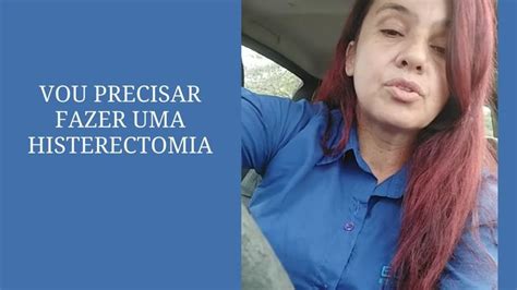 Histerectomia O Que Mioma Descoberta Do Mioma Uterino Exames