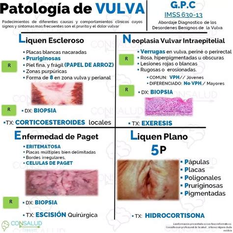 Pin De Priscilla H En Salud Obstetricia Obstetricia Y Puericultura