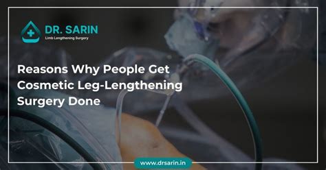 Reasons Why People Get Cosmetic Leg Lengthening Surgery Done Dr Sarin