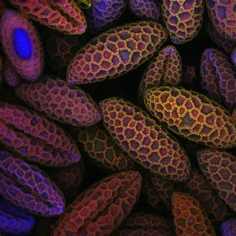 Nikon S Photomicrography Contest Puts Spectacular Science Under The Microscope