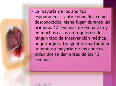 Unidad Ii Sexualidad Tipos De Aborto