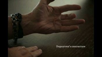 Xiaflex Tv Spot Dupuytren S Contracture Hand Specialist Ispot Tv