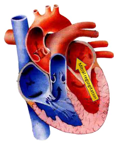 Degenerative Mitral Valve Disease Gulf Coast Veterinary Cardiology