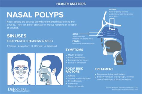 Can Dog Hair Cause Nasal Polyps