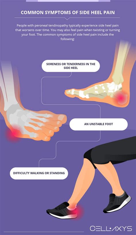 Side Heel Pain What You Should Know Cellaxys