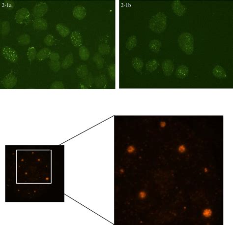 Figure 1 1 From ROLE OF FANCM IN TELOMERE MAINTENANCE IN ALTERNATIVE