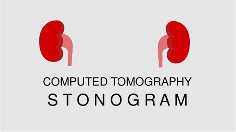 CT Stonogram