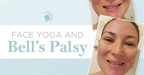 How Face Yoga And Facial Exercises Can Help With Bell S Palsy