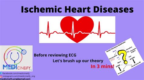 Ischemic Heart Diseases Ihd Classification For Ecg Youtube