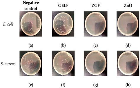 Sensors Free Full Text Graphene Incorporated Electrospun Nanofiber