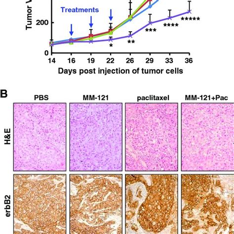 The Combination Of Mm 121 And Paclitaxel Significantly Inhibits Tumor