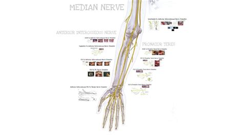 Nerve Transfers For Median Nerve Injuries Surgical Education Learn Surgery Washington