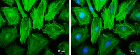 Anti-beta Actin antibody (GTX124213) | GeneTex