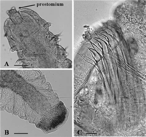 Adult morphology of Dipolydora cf. giardi . A , anterior end, dorsal ...