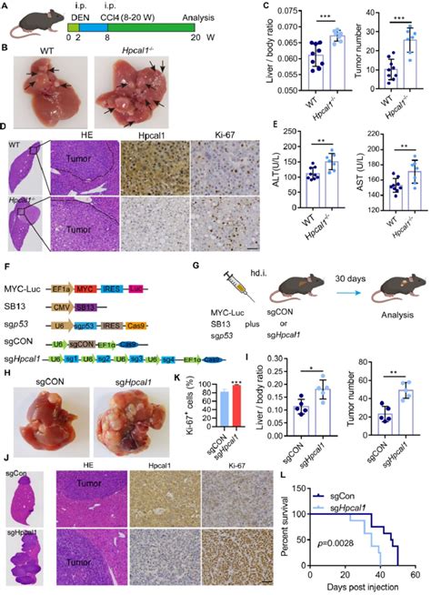 Genetic Loss Of Hpcal1 Results In Enhanced Liver Tumorigenesis A Download Scientific Diagram