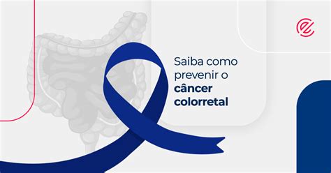 Saiba Como Prevenir O Câncer Colorretal