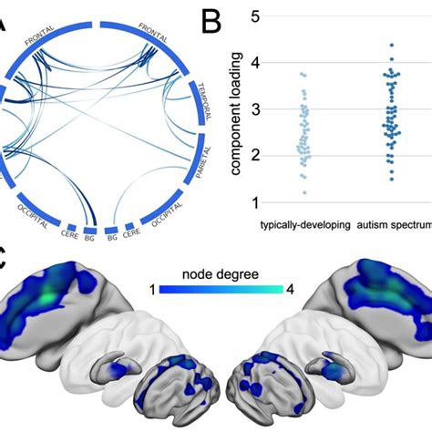 Structural Connectivity Is Significantly Increased In ASD A Single