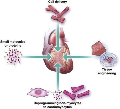 Cardiac Regeneration Strategies A Cell Therapy With Cultured Cells