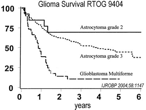 Glioma: Glioma Brain Tumors Prognosis