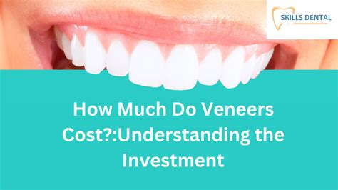 How Much Do Veneers Costunderstanding The Investment