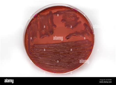 Growing Bacteria In Agar Medium In Microbiology Lab Making Streak In A