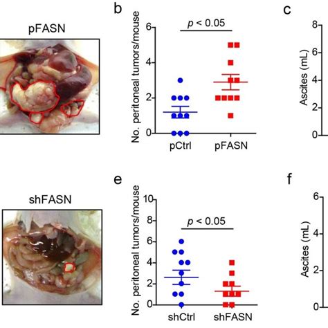 Mechanism Of Fasn Controlling Emt In Ovarian Cancer A Model Is